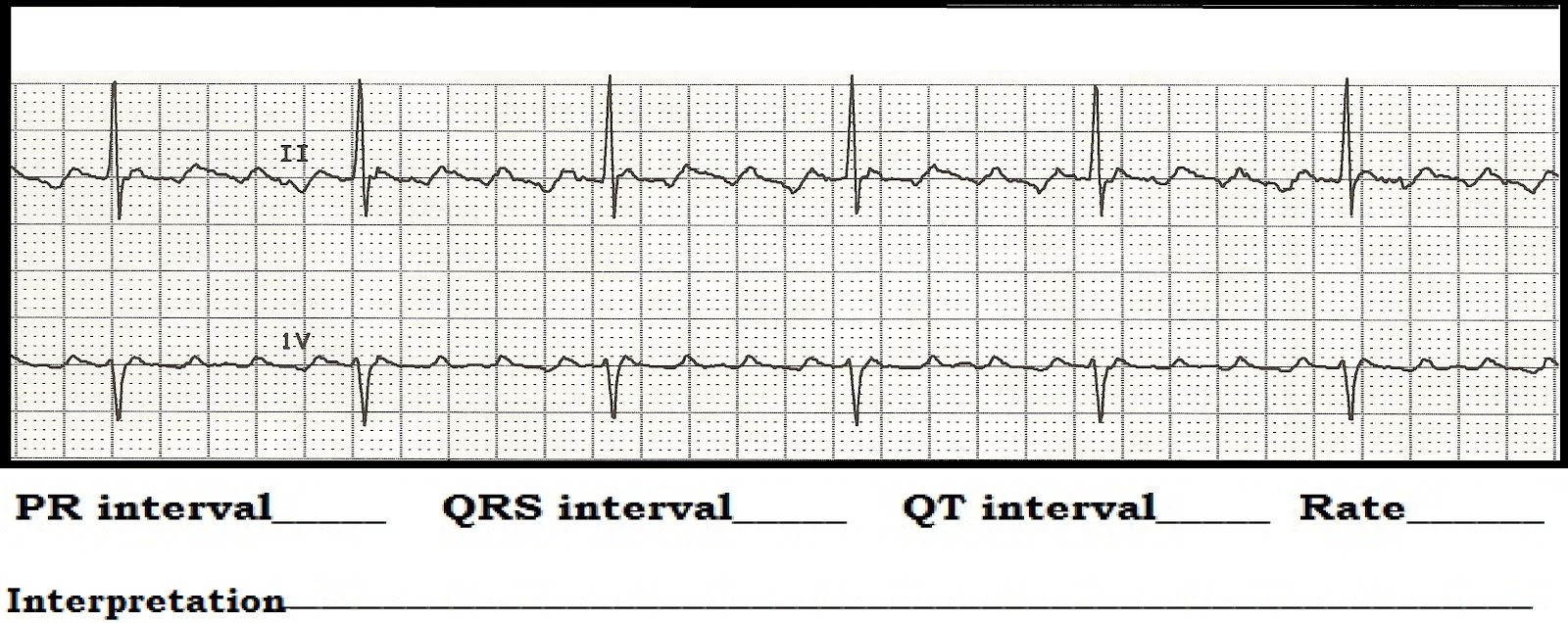 Ekg Practice Test With Answers