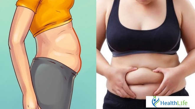 Dangerous complications of obesity Dangerous complications of obesity