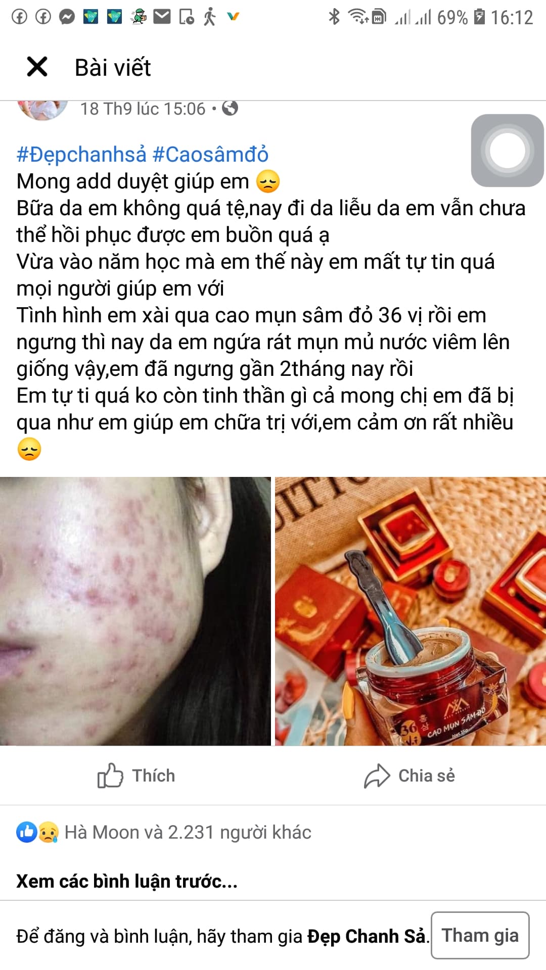 cao mụn sâm đỏ kem trộn