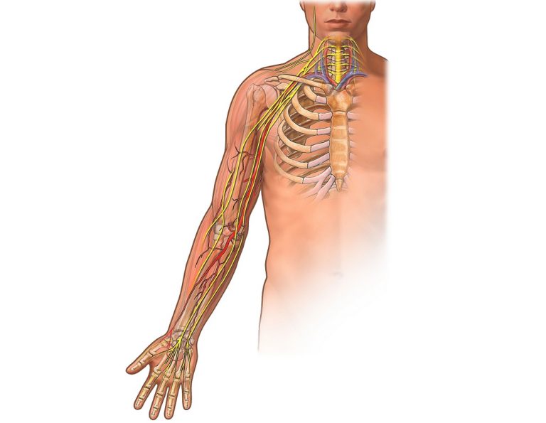 Médical & Paramédical Névralgie cervicobrachiale Causes,symptômes,Traitement