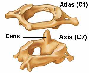 Atlas and Dens(Special Cervical vertebrae)