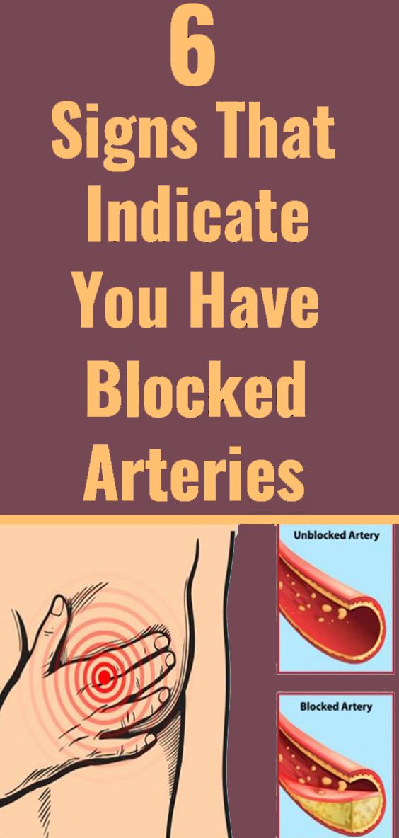 6 Signs of Clogged Arteries Healthy Clear
