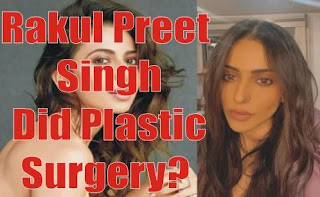 Rakul Preet Singh Did Plastic Surgery?Know More