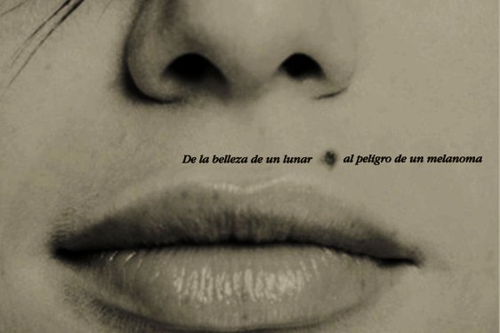 EL MÉDICO BLOG: LUNAR ó MELANOMA