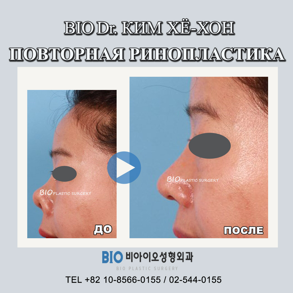 биос врачи. доктор пак благовещенск. биос пластическая хирургия. биос пластическая хирургия. чесночная инъекция.