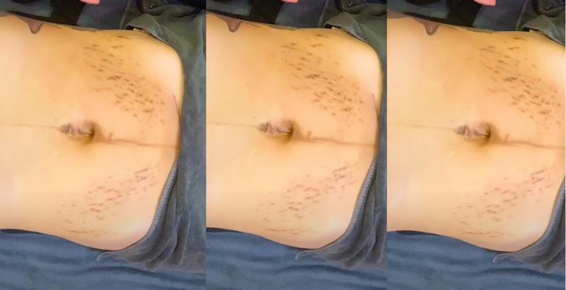 Thông tin quan trọng mà bệnh nhân và người nhà cần biết 4 Tiep vien hang khong Viet noi tieng xinh dep sau sinh no nhuan sac nho cho con bu screenshot 2021 10 28 163335 1635417334 213 width1000height513