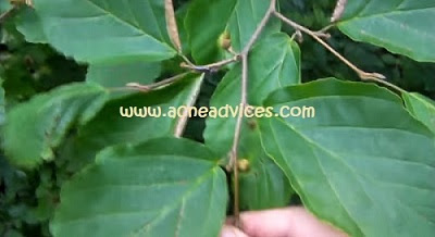 How to Reduce Your Acne Swelling with Witch Hazel Plant