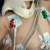 Polícia investiga pais após bebê ser levada ao hospital com mais de 30 lesões no corpo