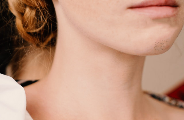 Get rid of blackheads with the use of these simple tips Get rid of blackheads with the use of these simple tips