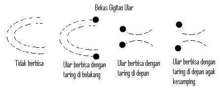 SEHAT ITU PENTING: PENATALAKSANAAN GIGITAN ULAR BERBISA