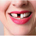 Awesome!! How To Make Your Teeth Grow In Just Few Weeks
