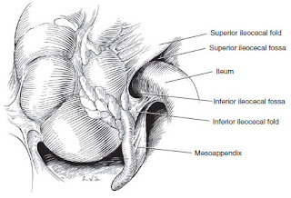 Acute Appendicitis anatomy