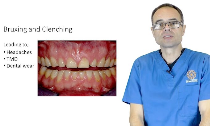 The Cause And Cure Of Bruxism And Clenching - Dr. Mike Mew