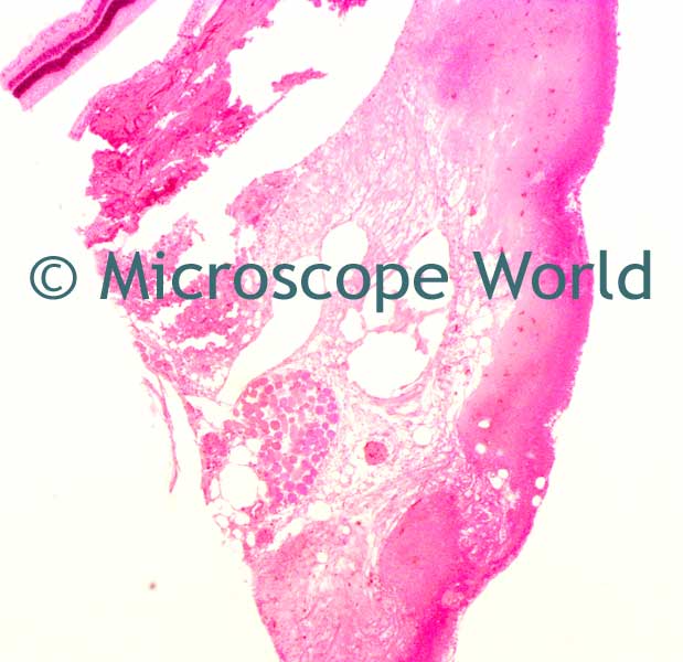 Microscope World Blog Optic Nerve Under the Microscope