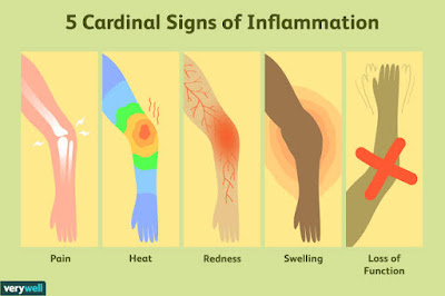 Inflammation: causes, nomenclature and classification Inflammation is a local response (reaction) of living vasculaized tissues to endogenous and exogenous stimuli