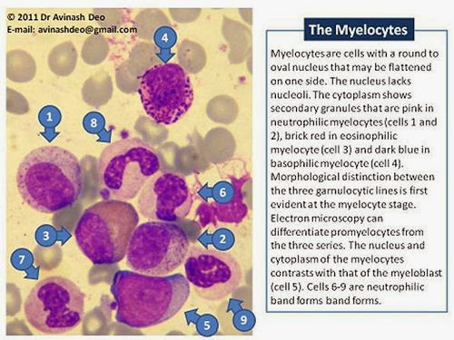 What Is Myeloid Precursors Abs Auto Medical Laboratory and Biomedical Science: Morphology of Myeloid Precursors