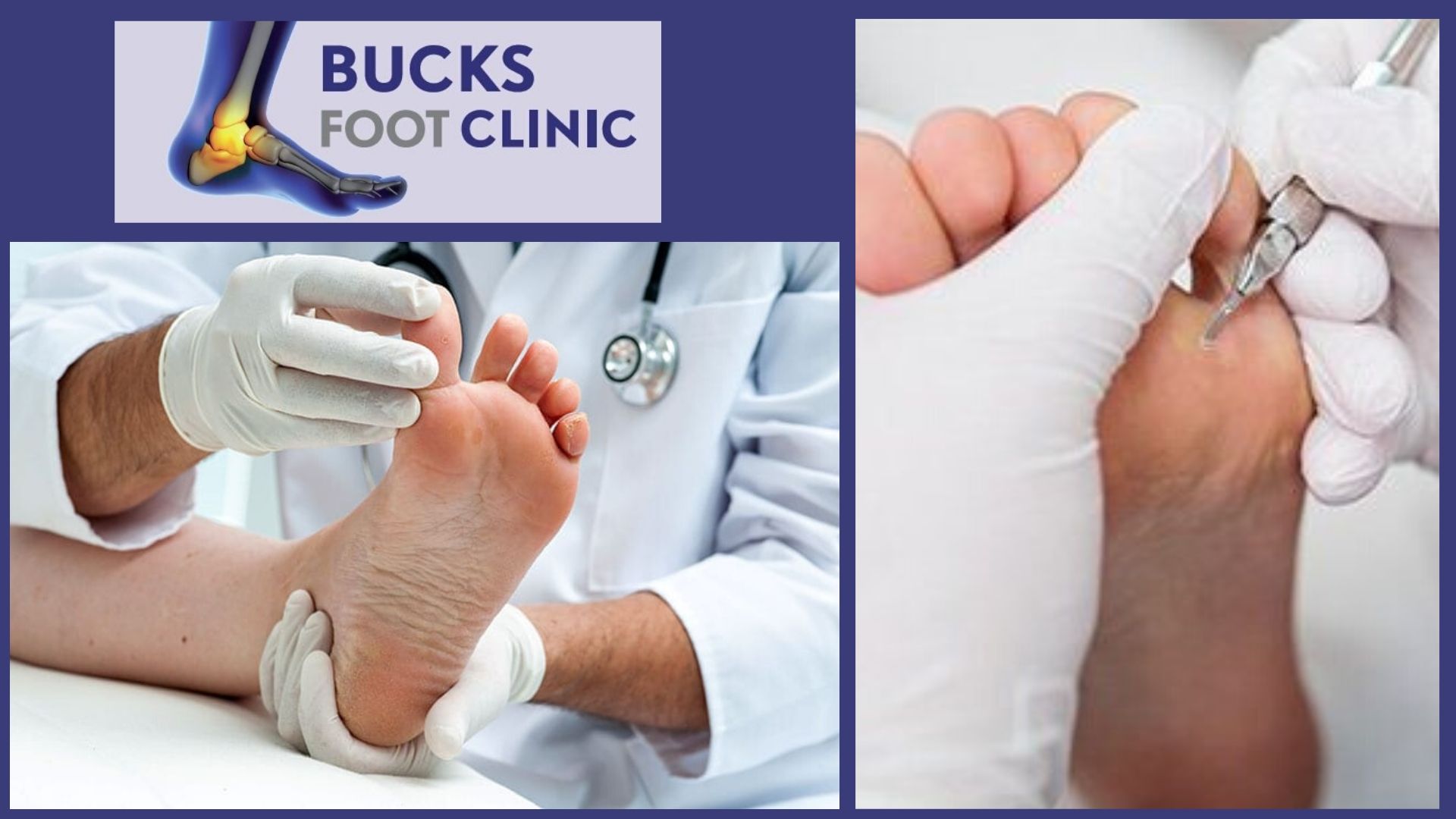 Know Everything About General Podiatry