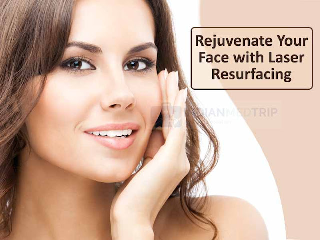 Rejuvenate Your Face with Laser Resurfacing