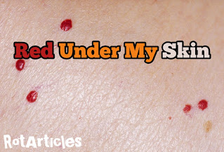 Red Under My Skin