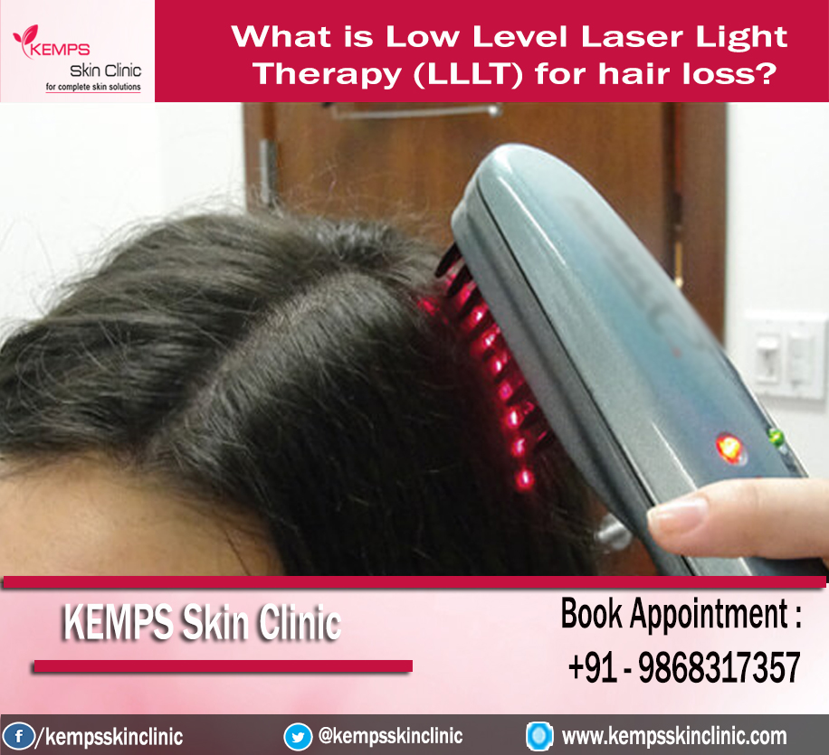 What is Low Level Laser Light Therapy (LLLT) for hair loss? KEMPS Skin Clinic