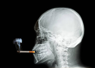 Jede Rauchentwöhnung ist anders - entzugserscheinungen rauchen