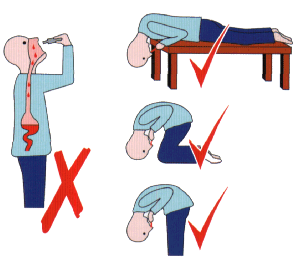 how to apply nasal drops?