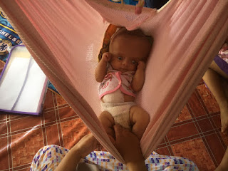 Bayi Asal Aceh Timur Penderita Hidrosefalus Butuh Uluran Tangan Dermawan Agustus 23, 2021