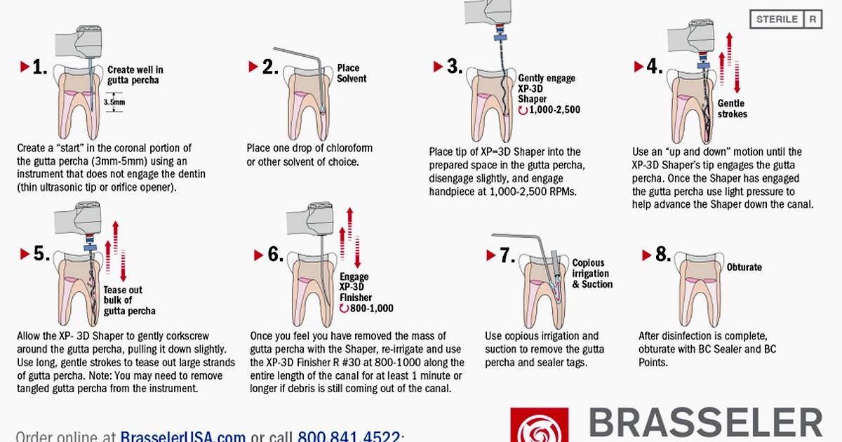 ENDODONTICS XP 3D Retreatment Technique Card OdontoTv