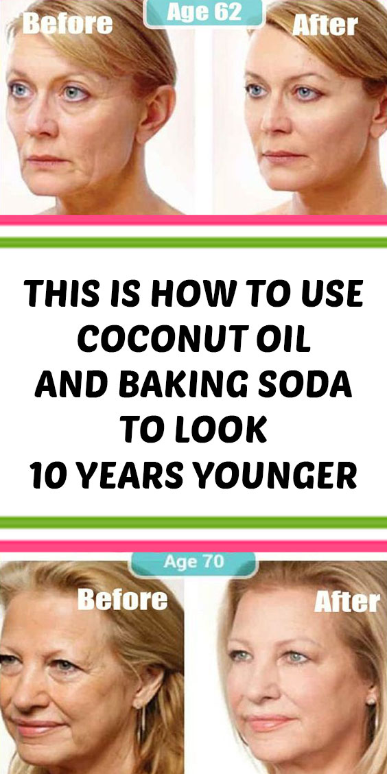 This Is How To Use Coconut Oil And Baking Soda To Look 10 Years Younger