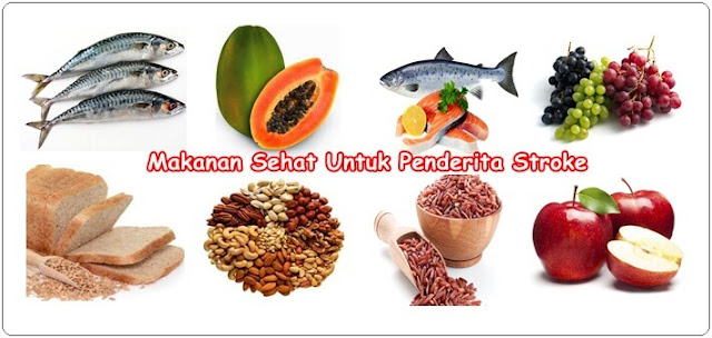 Tak Pernah Disadari Terlalu Sering Konsumsi Makanan Ini Penyebab Anda Cepat Terserang Stroke Tak Pernah Disadari Terlalu Sering Konsumsi Makanan Ini Penyebab Anda Cepat Terserang Stroke