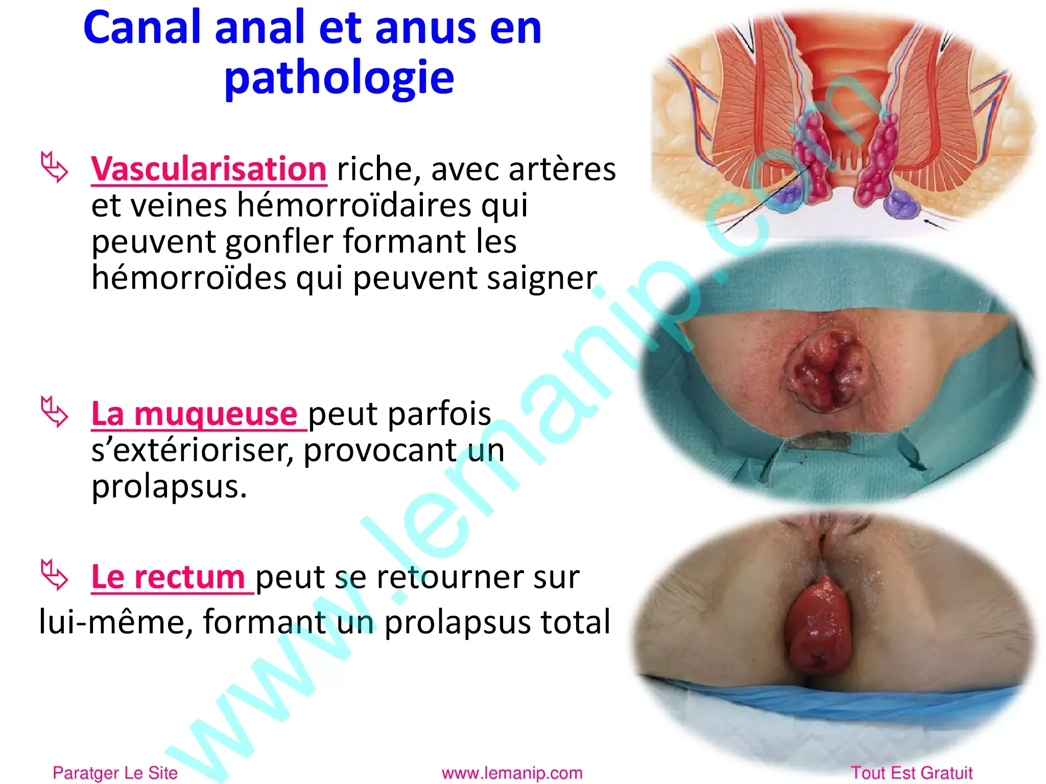 Canal anal, anus et pathologie