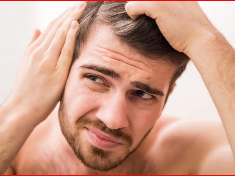 How To Prevent Hair Loss For Teenage Guys Naturally