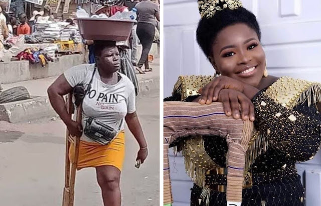 Amputee hawker shares amazing transformation photo as she celebrates her 27th birthday (Photos)