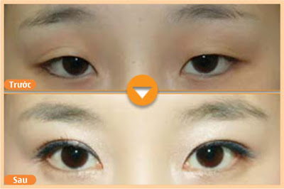 Khóe mắt là gì và cách tạo khóe mắt có thể bạn chưa biết