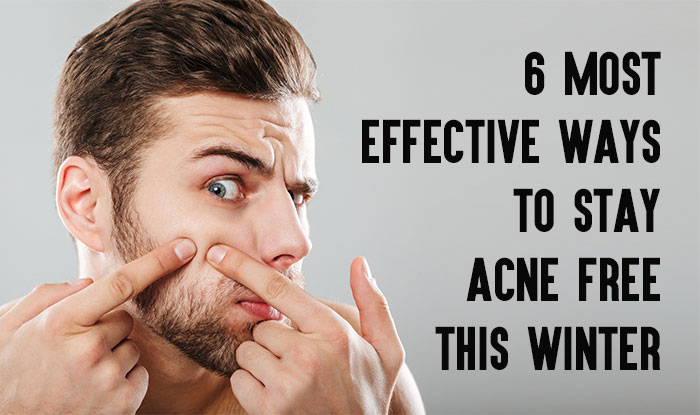 6 Most Effective Ways To Stay Acne Free This Winter