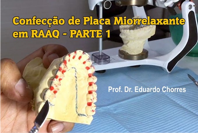OCLUSÃO: Confecção de Placa Miorrelaxante em RAAQ - PARTE 1 - Prof. Dr. Eduardo Chorres
