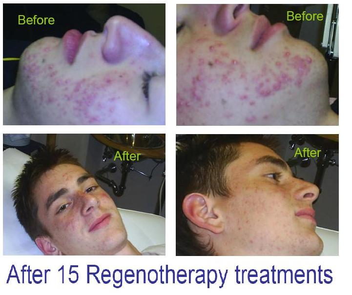 Regenoterapia® - Il futuro: Settori d'utilizzo