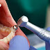 Cao răng có tác hại gì? 