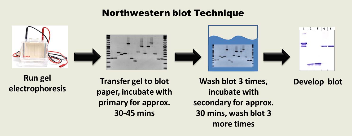 Southern Blotting- Northern Blotting- Western Blotting- Eastern blotting