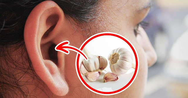 astuces-naturelles-pour-traiter-naturellement-le-mal-d-oreilles astuces-naturelles-pour-traiter-naturellement-le-mal-d-oreilles