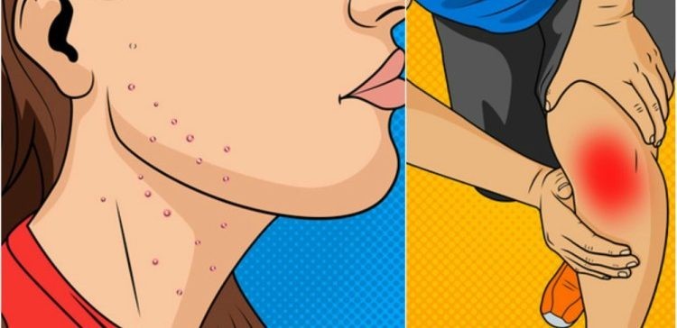 Sebelum Terlambat, Inilah Tanda Tubuhmu Kelebihan Gula Tanda%2BTubuhmu%2BKelebihan%2BGula