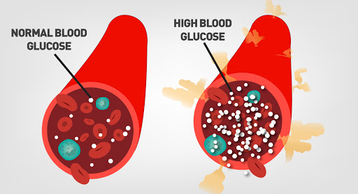 can type 2 diabetes cause hypertension