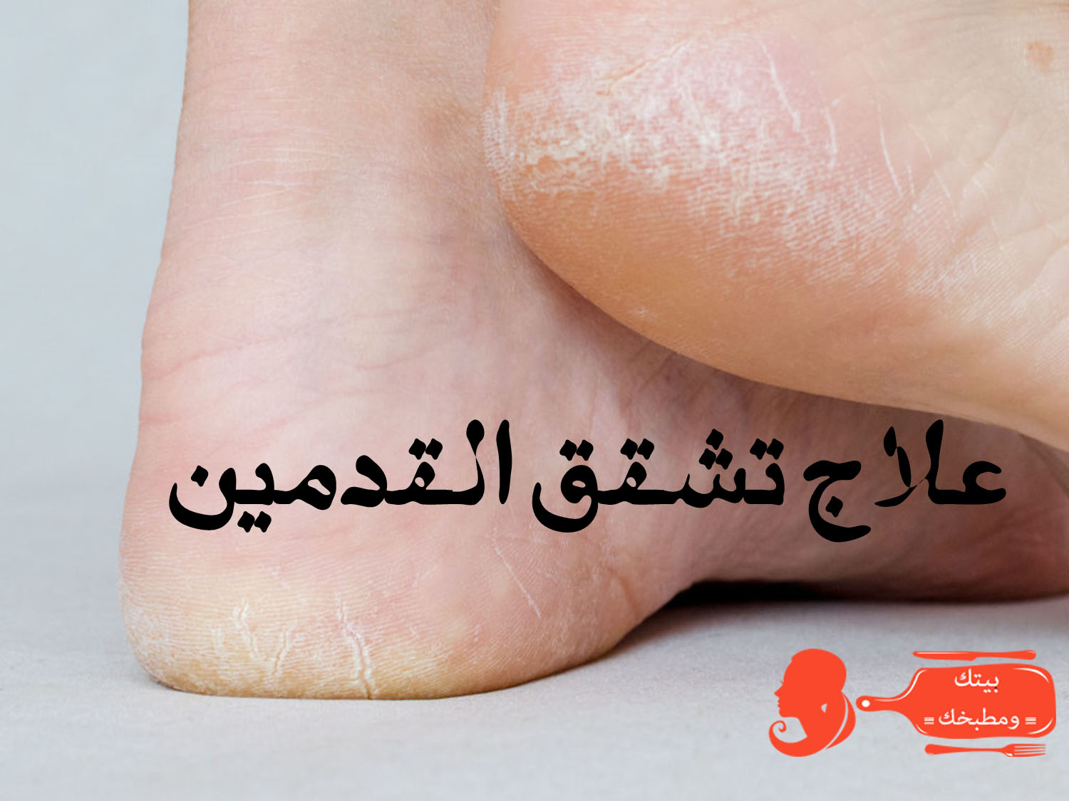 نصف كأس خل والفازلين و تخلصي من إسمرار الأرجل و التشققات من الإستعمال الأول و إلى الأبد Youtube