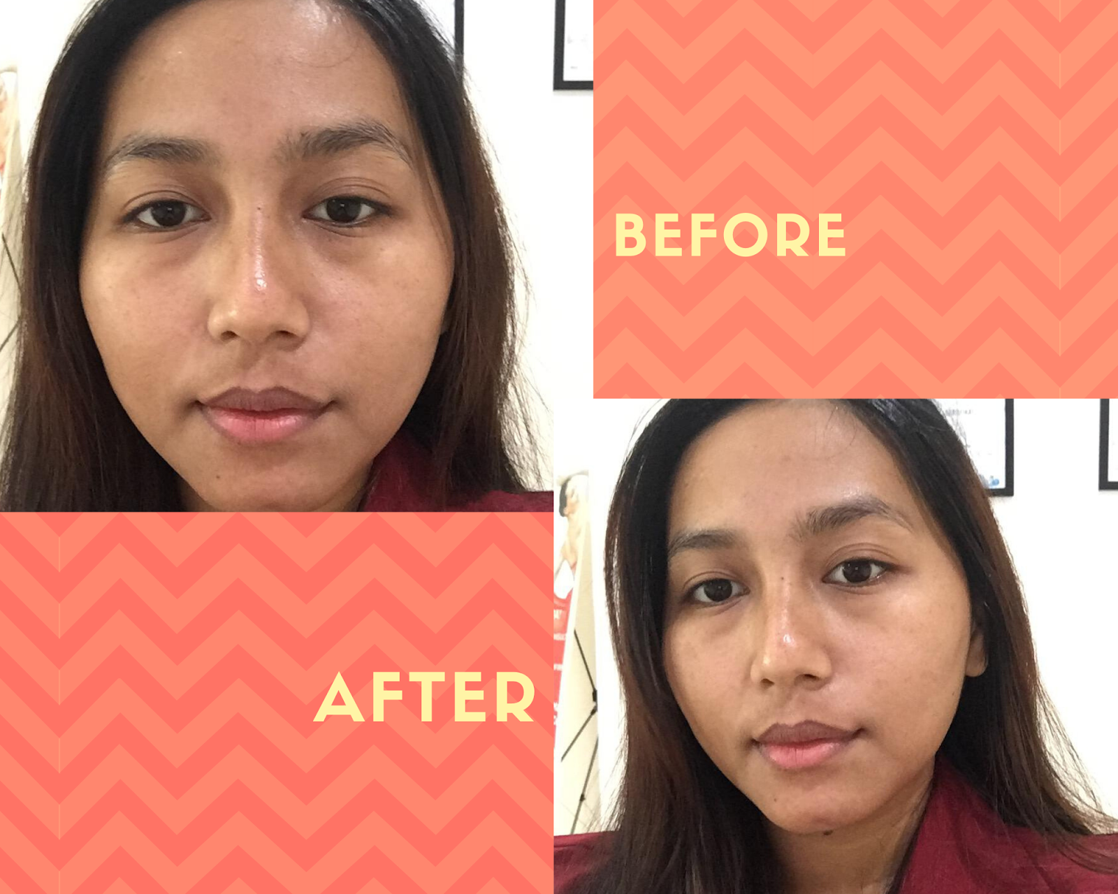 Kotak Kotak Arvi Review Perawatan Wajah Di Ella Skincare Kotak Kotak Arvi Review Perawatan Wajah Di Ella Skincare