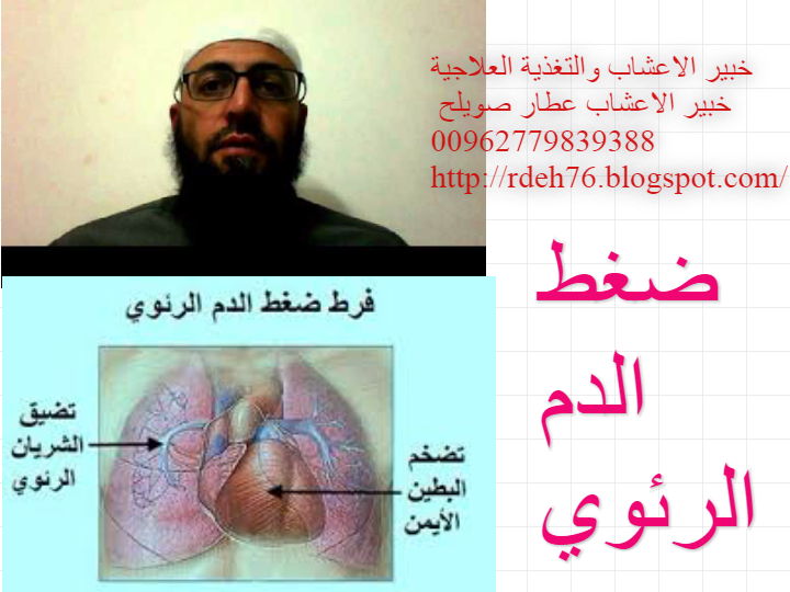 ضغط الدم الرئ وي امراض القلب والاعشاب