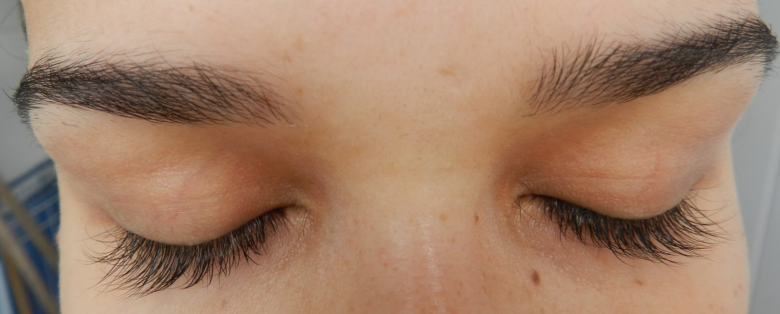 Oleo De Ricino Sobrancelha Antes E Depois