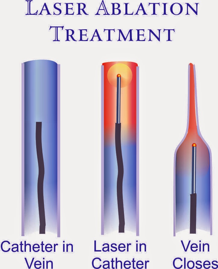 The Vein Center at Riverwoods