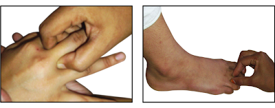 Acupressure point, Points of the Middle Finger.