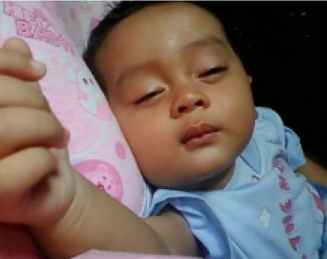 Inilah Penyakit Kulit Pada Bayi yang Harus Anda Ketahui