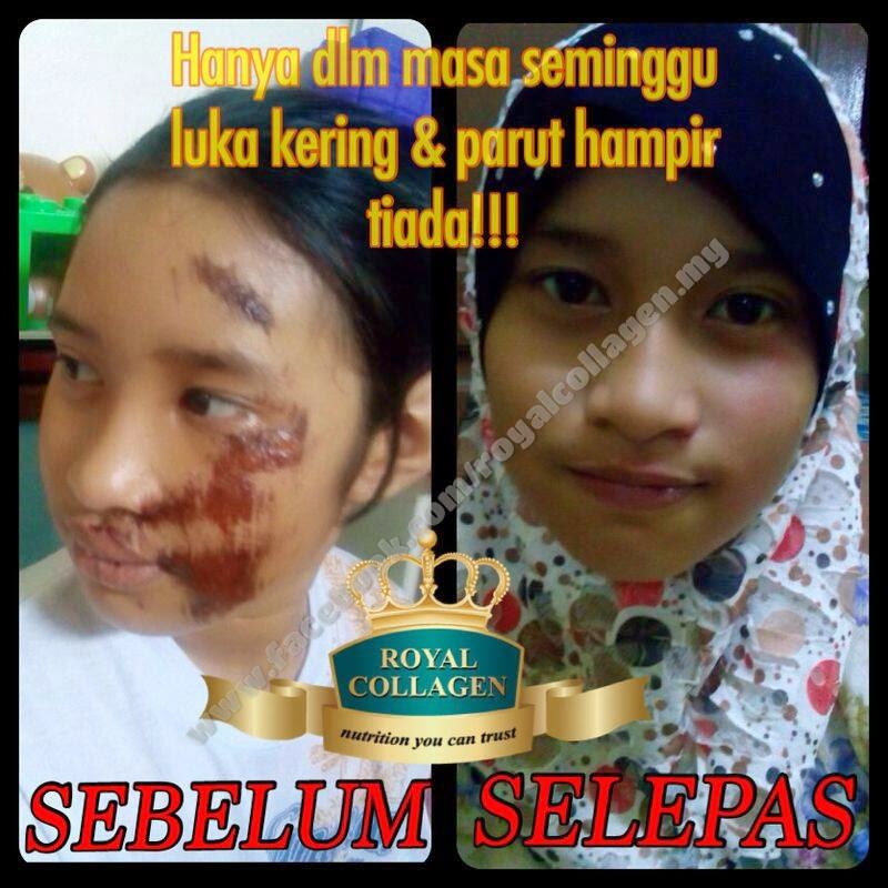 testimoni-royal-collagen-adik-sabrina.jp